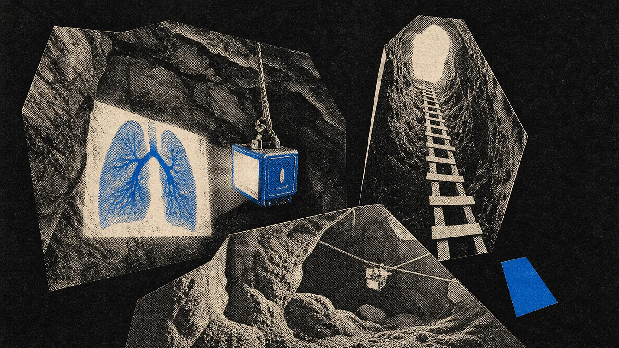구글 리서치, 결핵 선별 AI 현장 보급 성과 공개 · Image: METAL LAB
